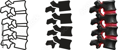 Fotografija Anatomical illustration of the human spine depicting healthy and inflamed interv