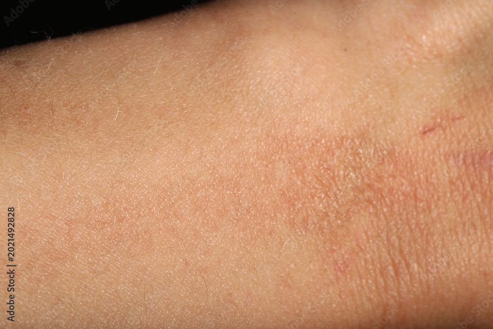 Fototapeta premium Texture of normal skin as background, closeup