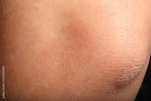 Konstfotografi Texture of normal skin as background, closeup