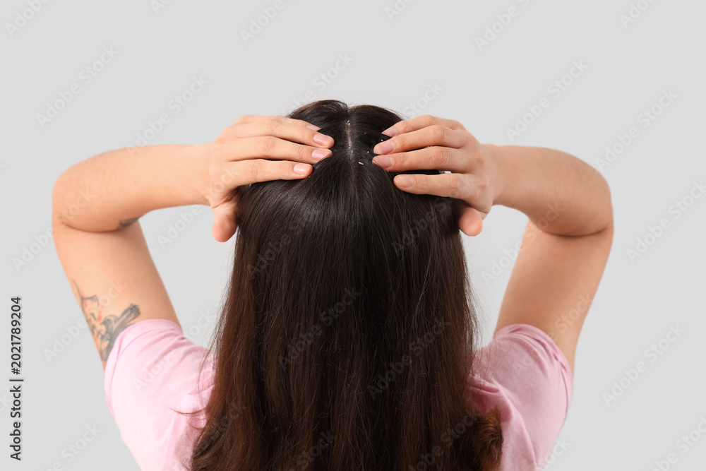 Naklejka premium Young woman with dandruff on light background, back view