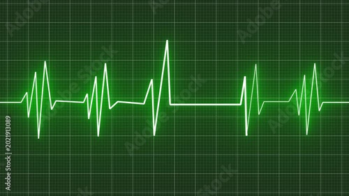 heartbeat pulse signal
