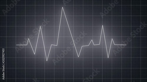 heartbeat pulse monitor signal 