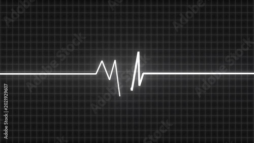 heartbeat pulse monitor signal 