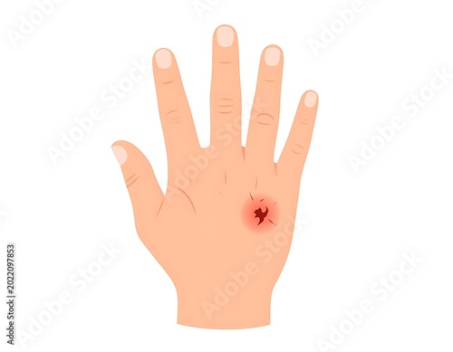 Injured hand with wound