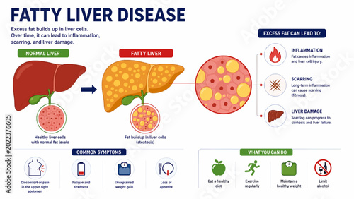 Принти на полотні Fatty Liver Disease Medical Infographic and Liver Damage Illustration