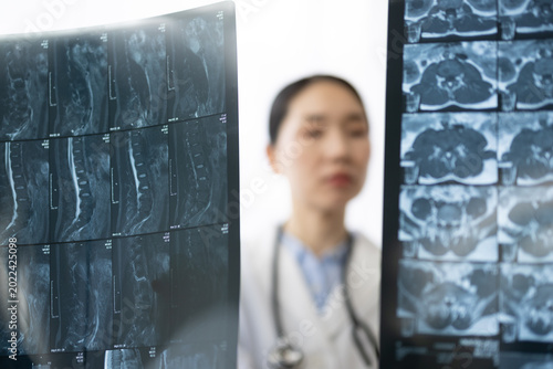 Photography Asian Female Doctor in White Coat Reviewing X-ray Image