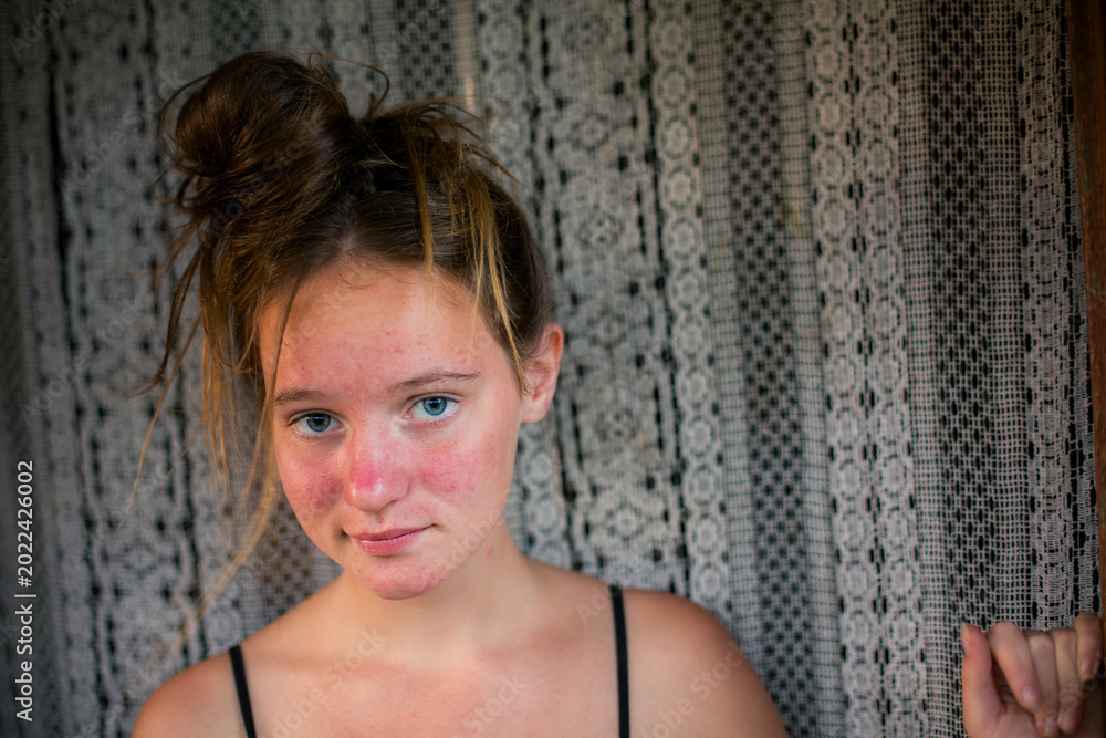 Fototapeta premium Portrait of teenage girl with freckles and blue eyes standing by lace curtain in soft window light indoors.