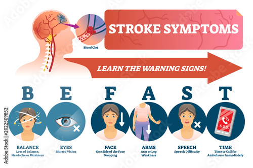 Bild auf Leinwand Stroke symptoms illustration, transparent background