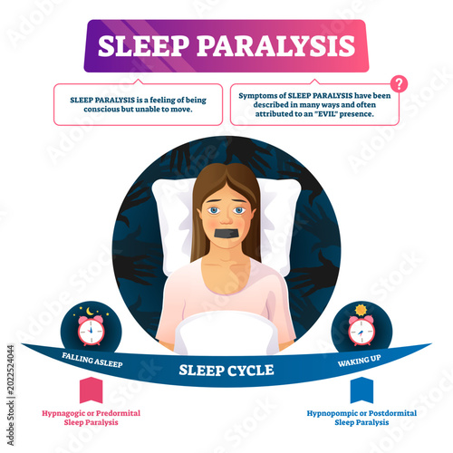 Quadro su tela Sleep paralysis illustration, transparent background