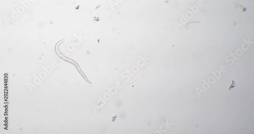 Parasitic nematode worm moving under a microscope