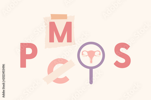 Bilde på lerret Creative flat vector illustration redefining the transition from PCOS to Polyendocrine Metabolic Ovarian Syndrome
