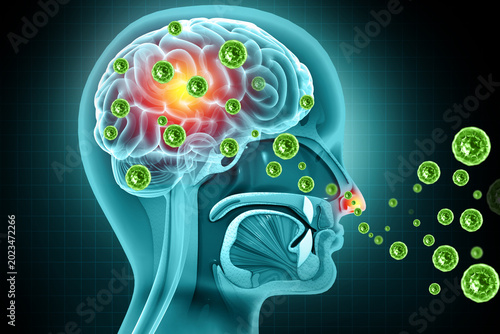 Photos Brain viral infection, Viral meningitis and encephalitis
