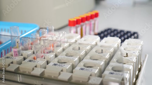 Lab technician holding blood tube sample for study. Medical technologist setting test tubes with human bio material sample into holder in hospital laboratory. 4 k video