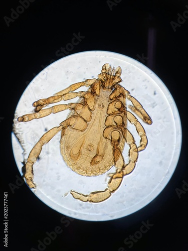 Microscopic view of a tick specimen on a slide, detailed anatomy of Ixodidae parasite under light microscope.