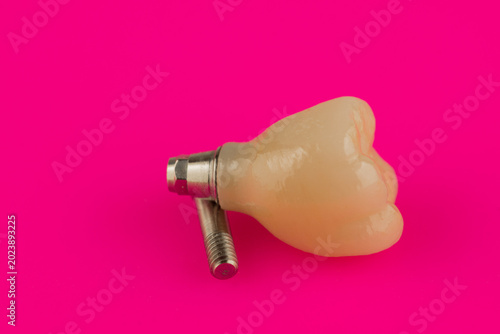 ceramic dental crown for fixation on a dental implant