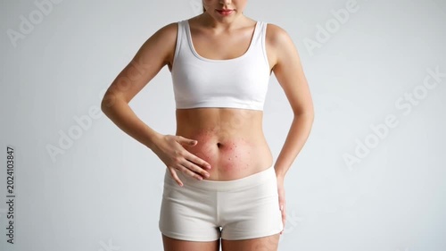 Woman showing skin allergy rash on belly red irritation concept -Generative AI