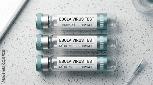 Ebola virus test tubes showing positive results on laboratory bench