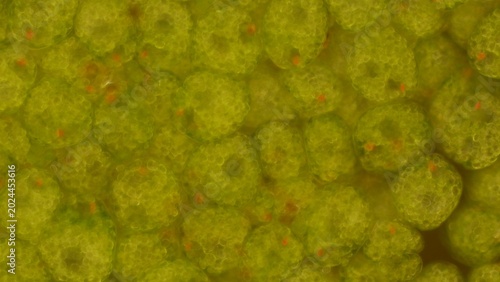 Quadro su tela Euglena sp. palmelloid stage at 20x darkfield microscopy