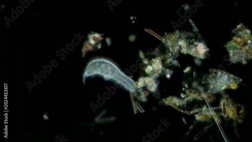 Foto Gastrotrich at 10x darkfield microscopy