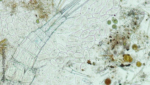 Fotografie Peritrichia sp. ciliates at 10x brightfield microscopy