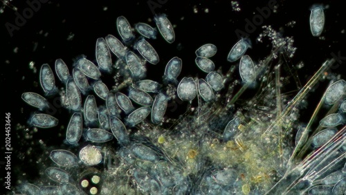 Bild auf Leinwand Peritrichia sp. colony at 10x darkfield microscopy