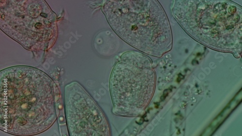 Foto Peritrichia sp. ciliates at 50x DIC microscopy