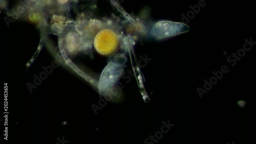 Bild auf Leinwand Peritrichia sp. ciliates at 20x darkfield microscopy