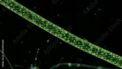 Foto Spirogyra filament at 10x darkfield microscopy