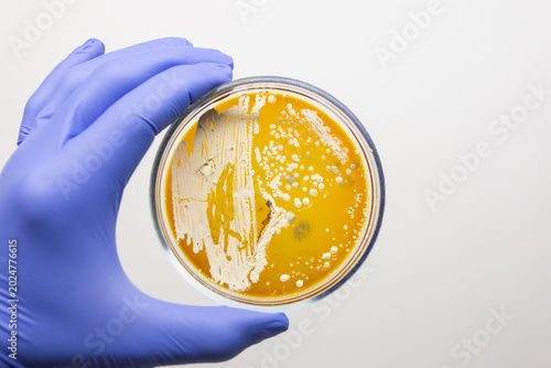 Konstfotografi A scientist holds a Petri dish containing white bacteria on an orange nutrient medium