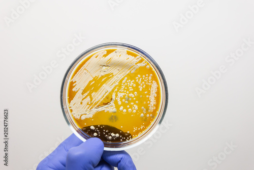 Vászonkép White bacterial colonies on an orange nutrient medium.