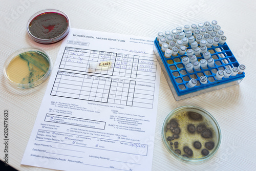 Canvastavla Laboratory protocol for counting the number of bacteria in a Petri dish and a test tube with a sample of Escherichia coli