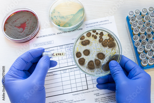 Canvastavla A scientist holds a petri dish containing dangerous bacterial clones and a test tube containing Escherichia coli bacteria against the backdrop of a laboratory protocol
