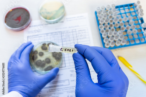 Quadro su tela A doctor holds a small test tube with a strain of Escherichia coli against the background of a laboratory form, petri dishes, and a rack with test tubes