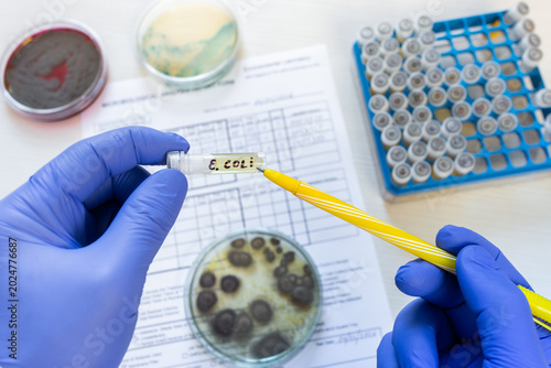 Tableau sur toile The doctor points with his pen to a small test tube with a yellow liquid and the inscription Escherichia coli; on the table there is a laboratory protocol and petri dishes