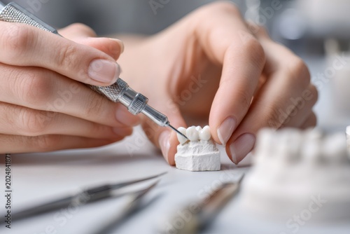 Dental technician working on a ceramic crown in a laboratory. Dentist hands making a prosthetic tooth bridge on a plaster model. Stomatology and healthcare concept