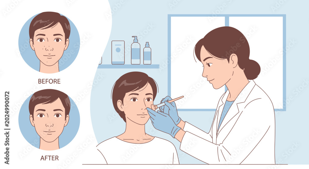 Fototapeta premium Man getting facial filler injection, before and after aesthetic procedure illustration