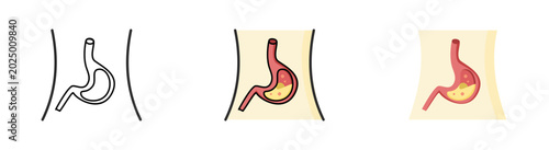 Foto Set of Gastroesophageal Reflux Disease (GERD) on white background