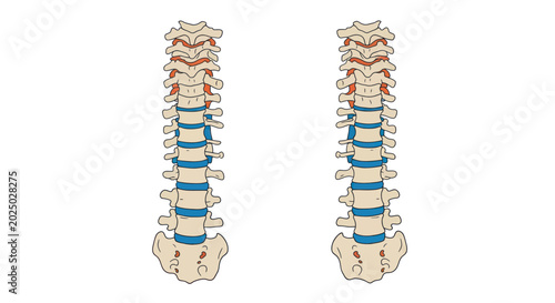 Quadro su tela Human Spine Anatomy Comparison: Healthy vs. Damaged Vertebrae