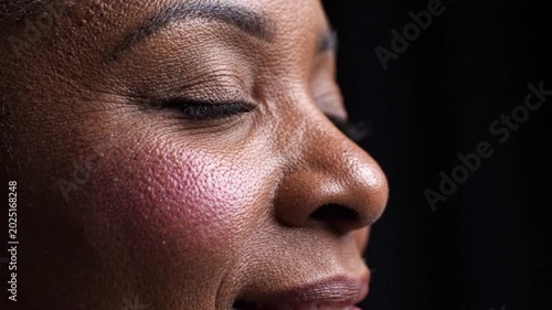 Close-up of woman's face with rosacea