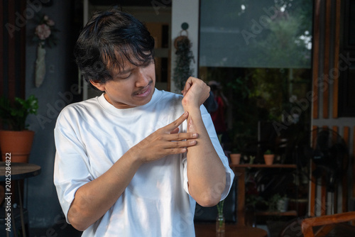 A Southeast Asian man suffering from first-degree burn wound on his left hand, his other hand holding the area near the wound