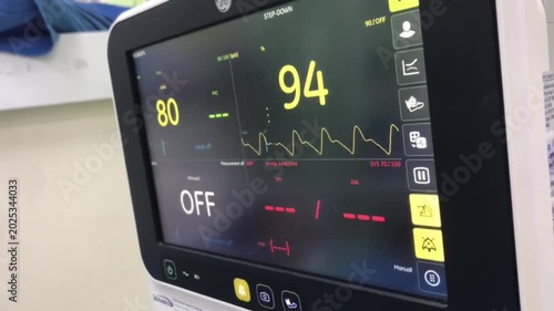 Vital Signs Monitor Display: A close-up shot of a medical monitor screen displaying vital signs, including heart rate and oxygen saturation levels, with a clear OFF status indicator.