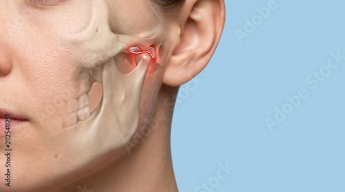 3D medical illustration of human jaw anatomy showing temporomandibular joint dysfunction with red inflammation highlight on a female face