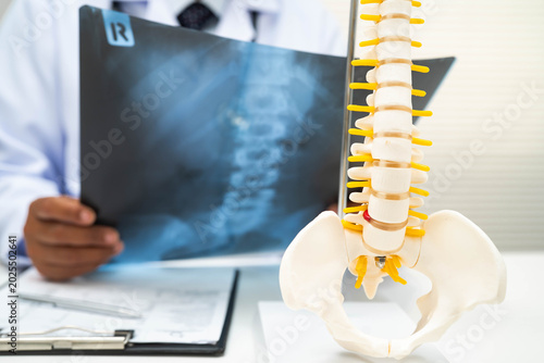 Tableau sur toile Doctor examining spine bone radiography xray film.