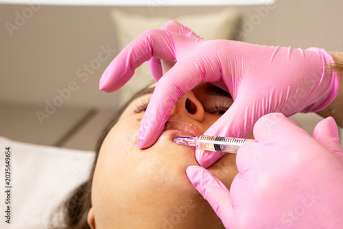 Quadro em tela A picture of a very beautiful and attractive young lady showing the lip injection and rejuvenation process, in a professionally designed office
