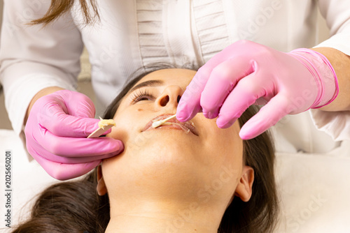 Photos A picture of a very beautiful and attractive young lady showing the process of lip injection and rejuvenation, in a professionally arranged office