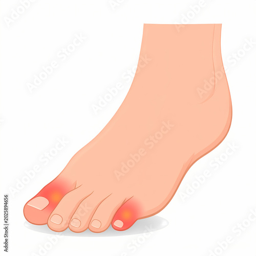 Human foot with swollen red toe joints