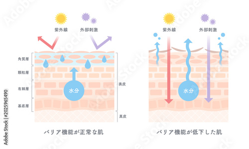 正常な肌とバリア機能が低下した肌の違いを示したシンプルな肌構造図解イラスト