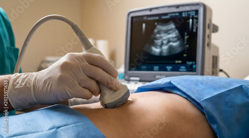 Medical professional applying ultrasound probe to patient abdomen with screen showing scan