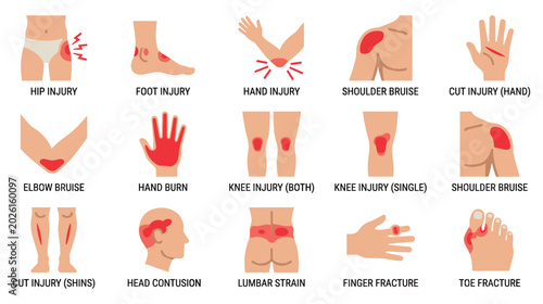 Tableau sur toile Human body injury diagram showing various physical trauma points.