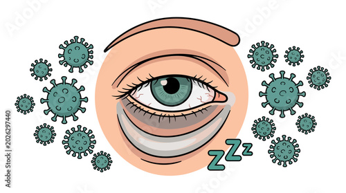 Fatigued Human Eye Surrounded by Virus Microbes and Sleep Symbols